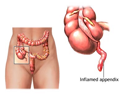 Appendiks