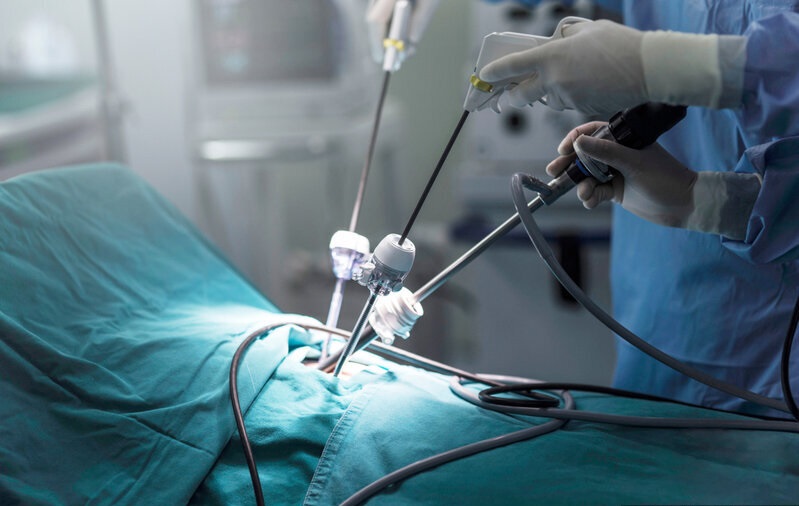 Laparoskopik əməliyyat